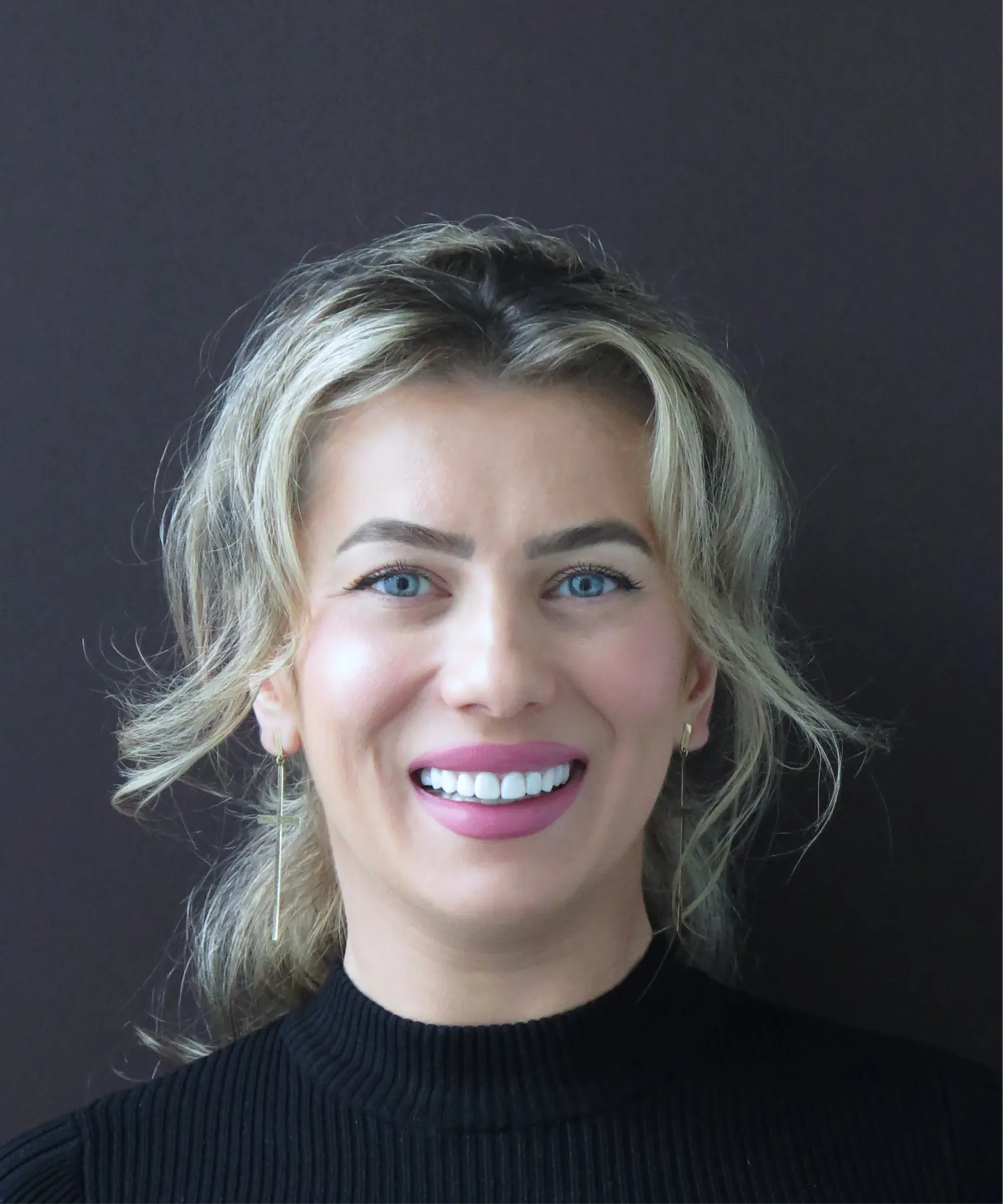 Rezultatul după tratament — estetică dentară, comparația 1