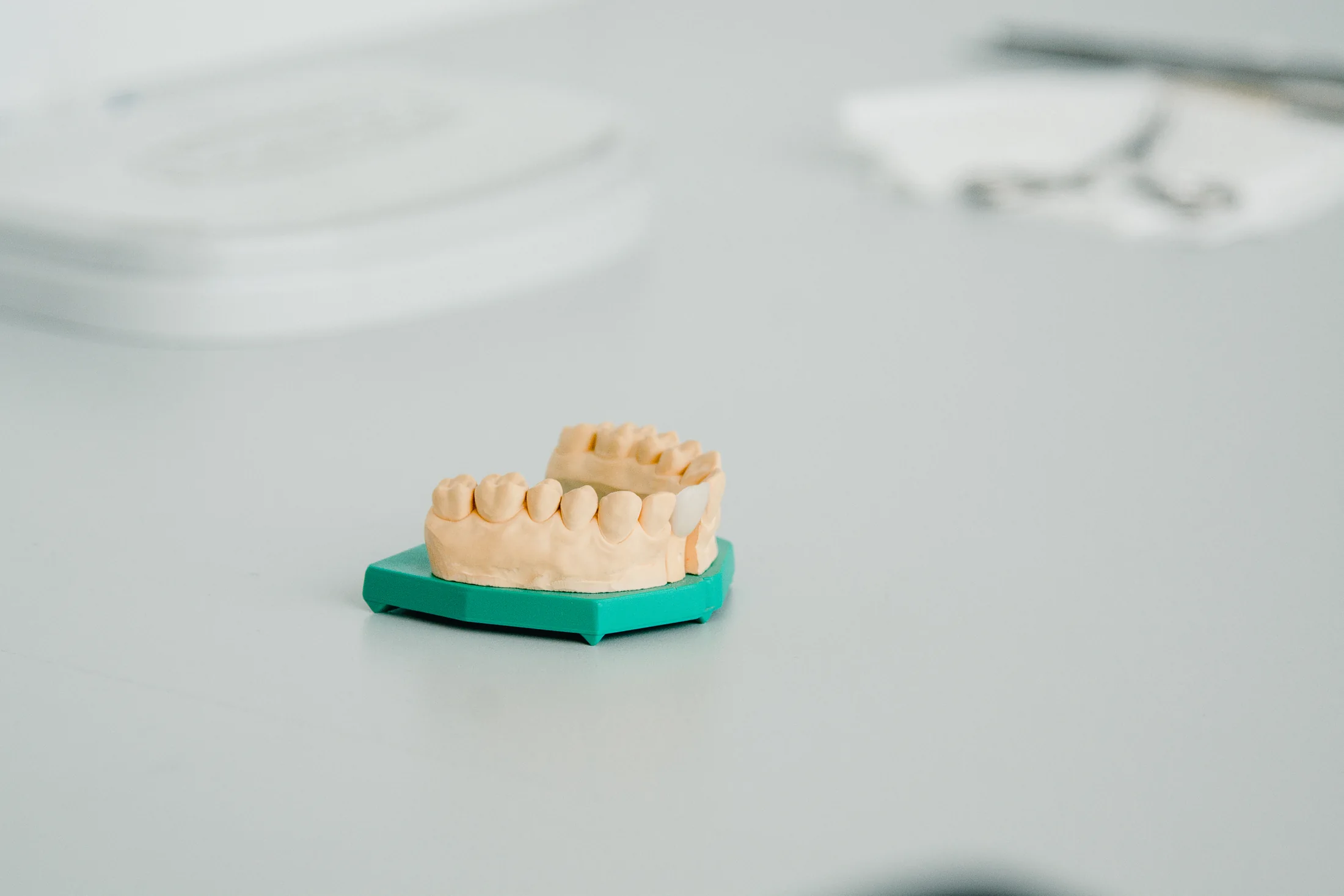 Model dentar folosit pentru verificarea restaurărilor estetice