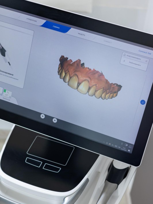 Scanare CBCT 3D pentru planificare dentară