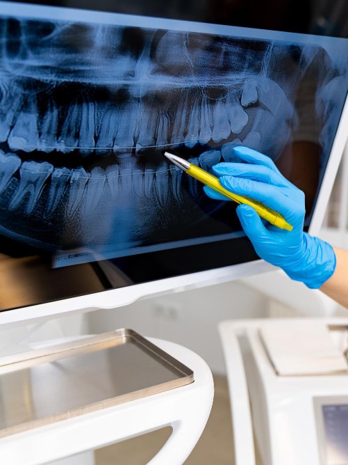 Medic analizând radiografie pentru diagnostic precis