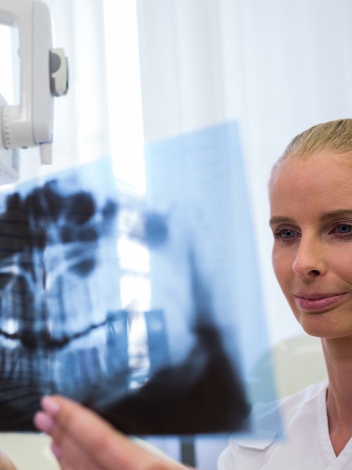 Radiografie panoramică pentru evaluare completă